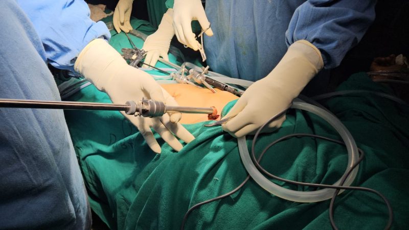 लेप्रोस्कोपिक सर्जरी से हुआ पित्त की थैली का सफल ऑपरेशन: बौराड़ी जिला अस्पताल ने रचा नया इतिहास