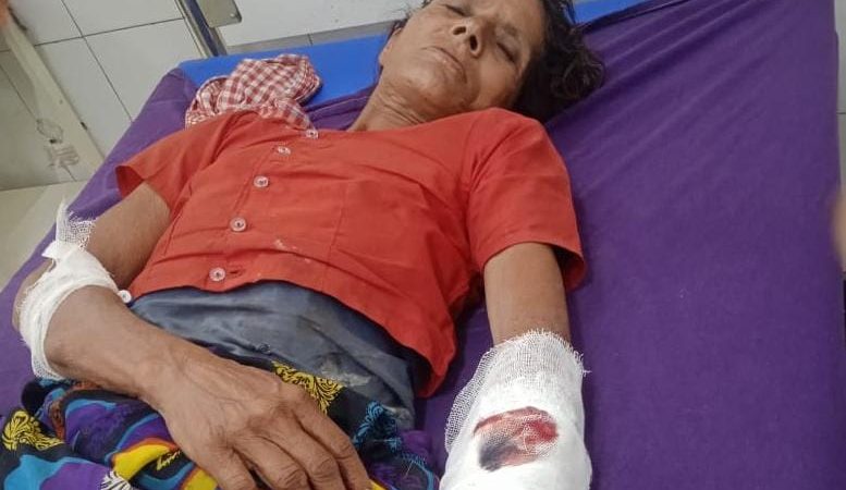 घास लेने गई महिला पर जंगली सूअर का जानलेवा हमला: खून से लहुलूहान हालत में पहुंची अस्पताल