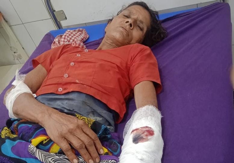 घास लेने गई महिला पर जंगली सूअर का जानलेवा हमला: खून से लहुलूहान हालत में पहुंची अस्पताल