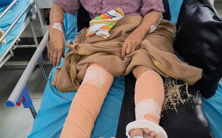🔴 ब्रेकिंग न्यूज: अज्ञात कांवड़ियों की टक्कर से बुजुर्ग घायल, अस्पताल में भर्ती